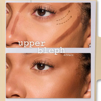 Upper cheek contour result
